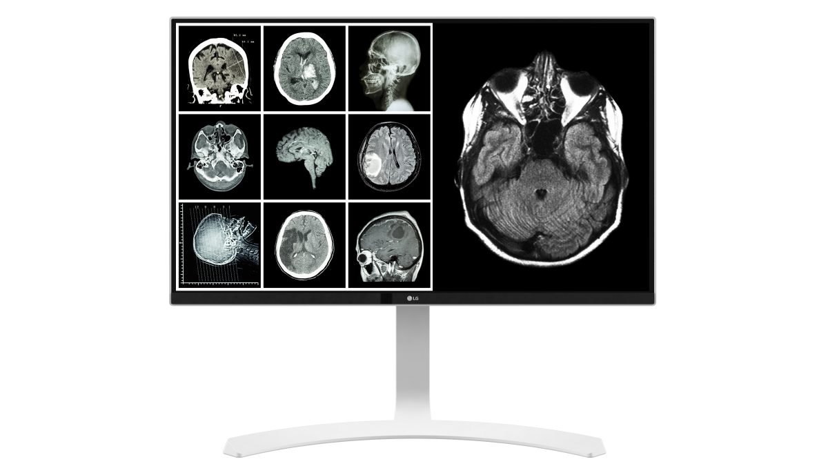 LG 27" 8MP CLINICAL MONITOR WH 27HJ712C-W