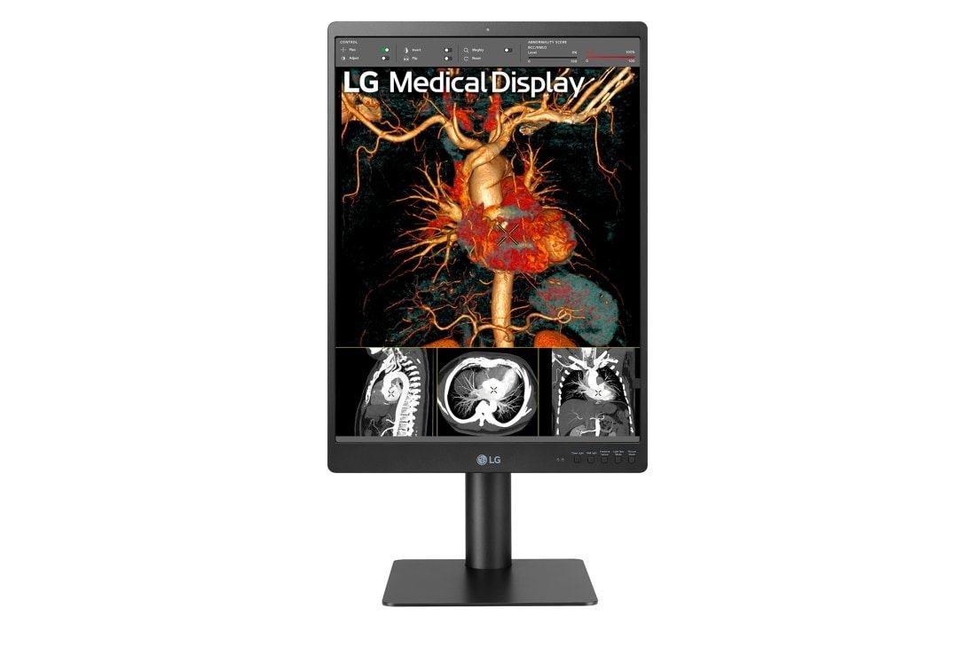 LG 21" 3MP DIAGNOSTIC MONITOR 21HQ513D-S