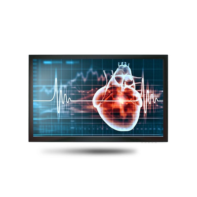 Onyx MEDDP-615 15.6in Medical Display 300 nits PCAP Touch VGA HDMI MEDDP-615HPN-A1-1010