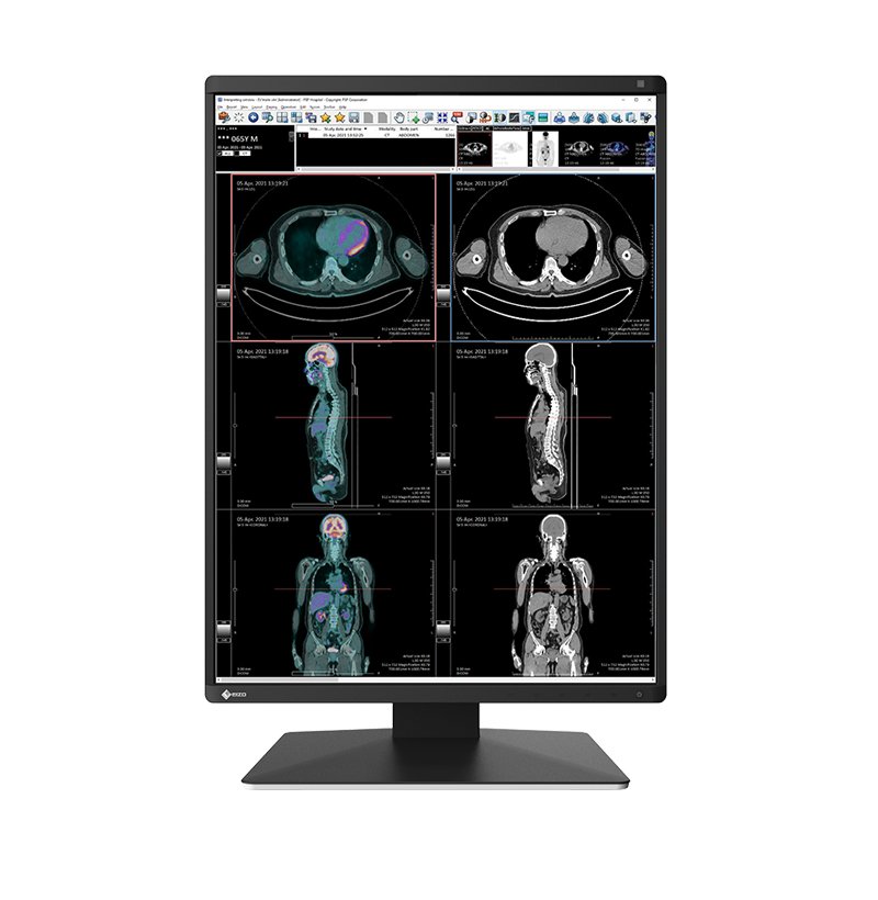 EIZO INC RadiForce RX370 computer monitor 54.1 cm (21.3") 1536 x 2048 pixels LCD Black RX370-BK