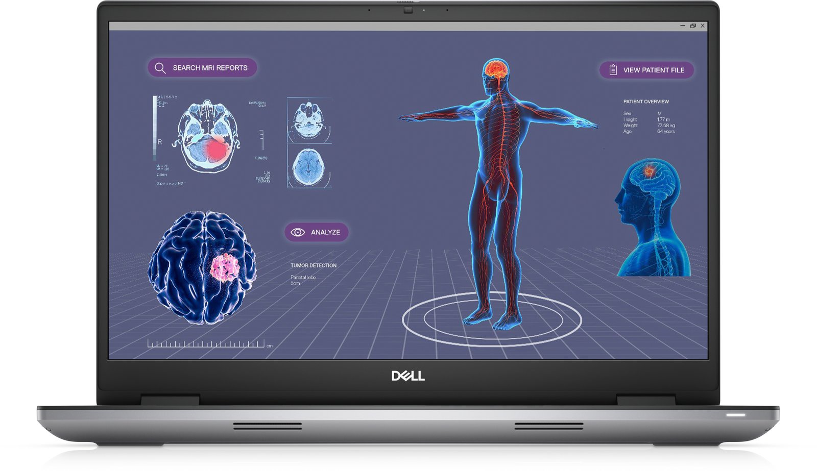 DELL WORKSTATIONS Precision 7780 Intel® Core™ i7 i7-13850HX Mobile workstation 43.9 cm (17.3") Full GK8JJ